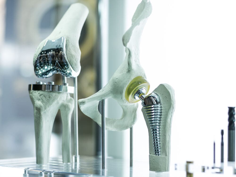 Knee and hip prosthesis for medicine